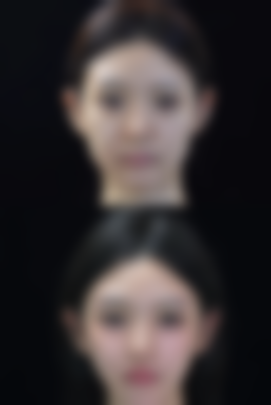 妙桃做隆胸效果怎么样？揭秘90%女性信赖的秘诀，是否成为你重塑自信的不二之选？ 