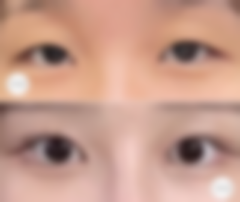 深圳回来整形美容医院擅长项目:开启多元美丽之门