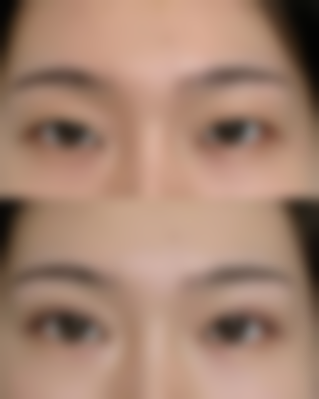 沈阳杏林整形祛眼袋靠谱吗？