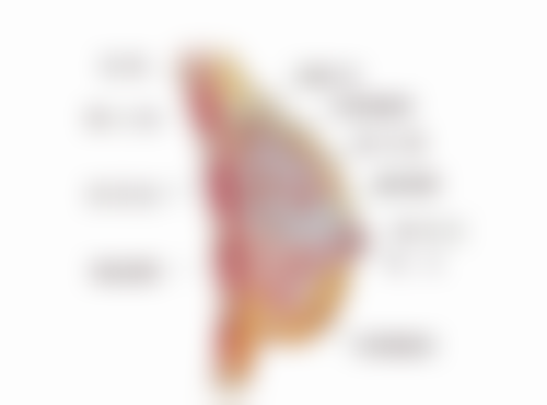 沈阳杏林整形外科医院抽脂后反弹的概率大吗？