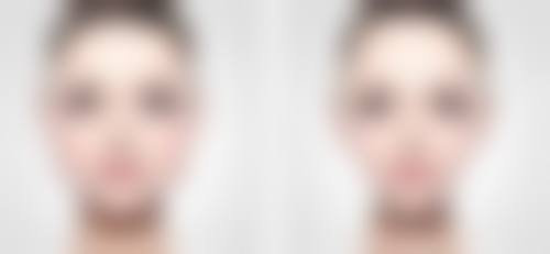 沈阳美莱医疗美容医院抽脂后适当运动的成效怎么样？