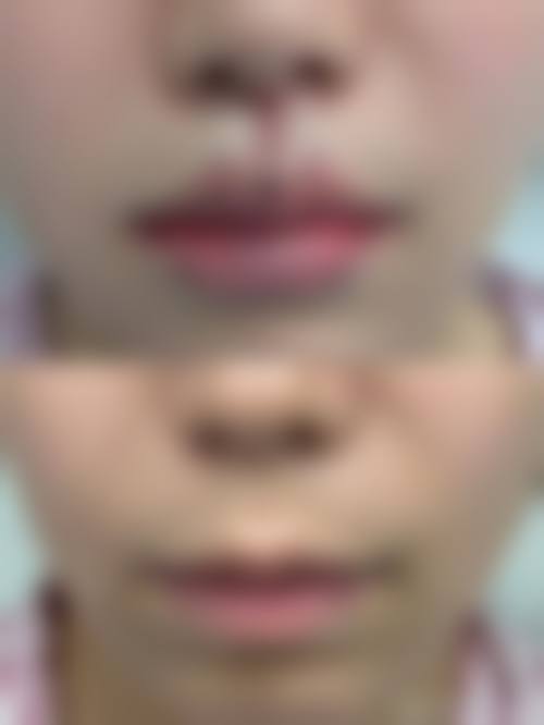 金华李丹医疗整形美容诊所营业时间:随时为美待命