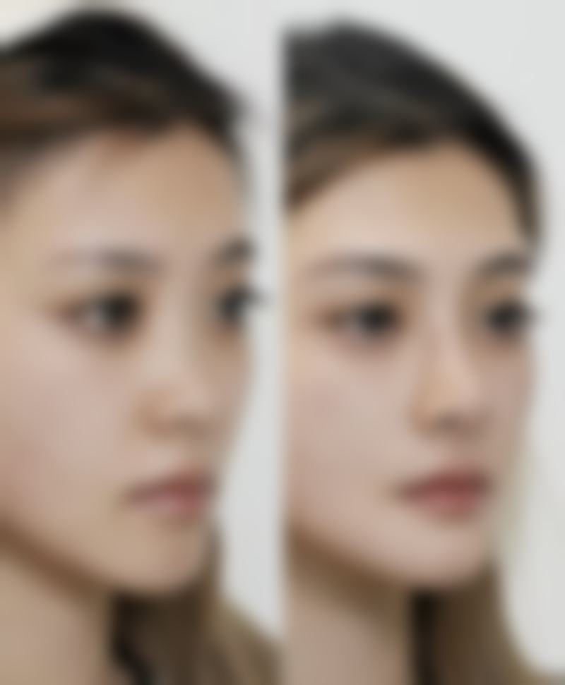 厦门宾小美医疗美容诊所真实实例：见证美丽奇迹