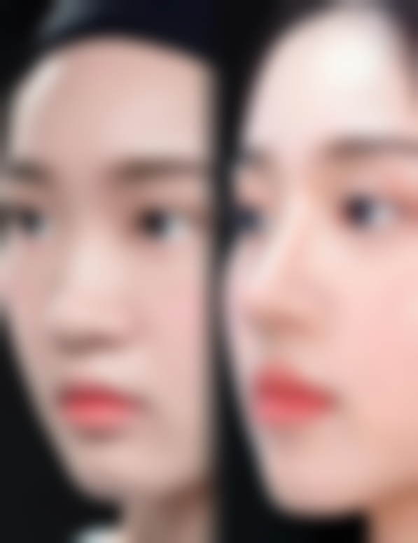 郑可扬医生擅长项目：全方面变得更美秘籍