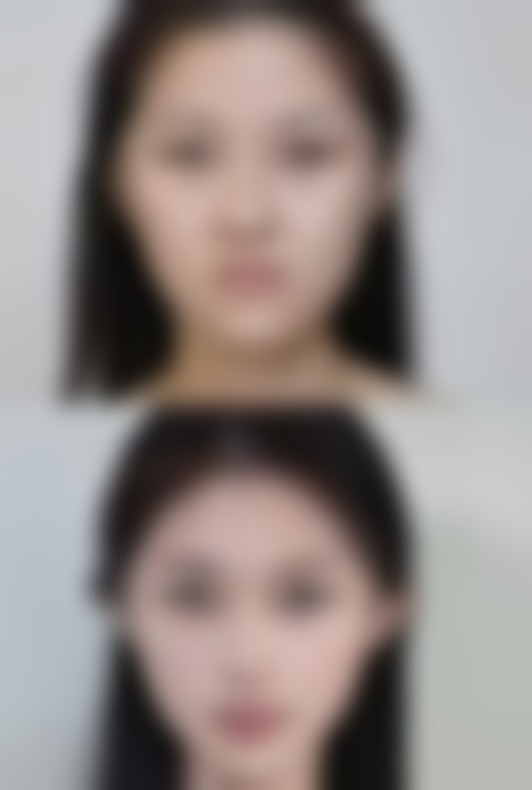 郑可扬医生的技术特点