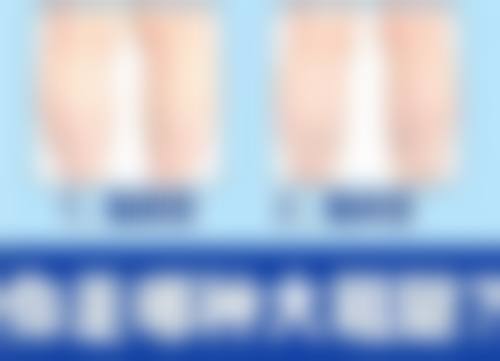 旧疤痕怎么才能去除？揭秘3种医美界超火祛疤方法，真的能让旧疤淡到几乎看不见，信了！ 