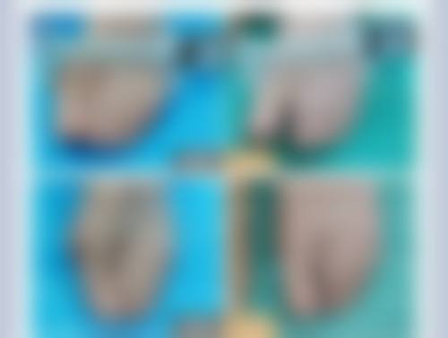 袁兴枝医生的技术特点