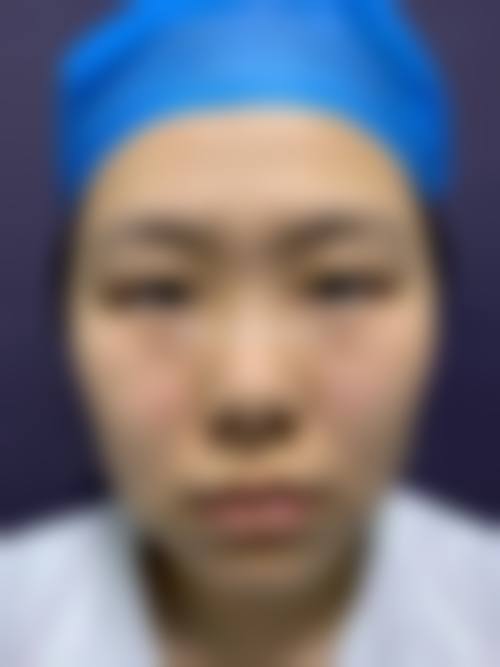 成县鑫合滤镜主义整形医院擅长项目