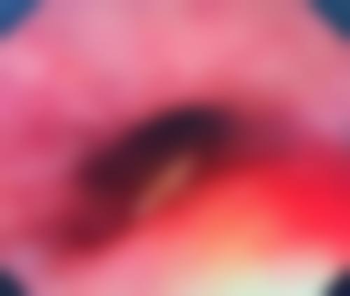 成县鑫合滤镜主义整形医院仪器设备