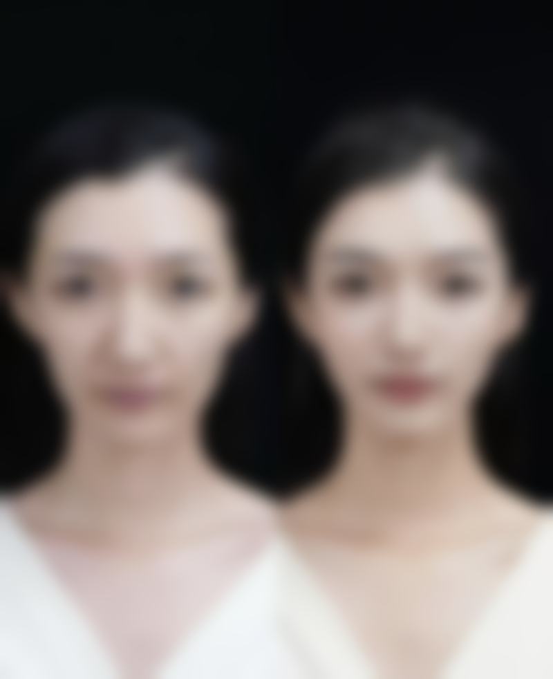 深圳广和尹骨干医生整形美容擅长项目