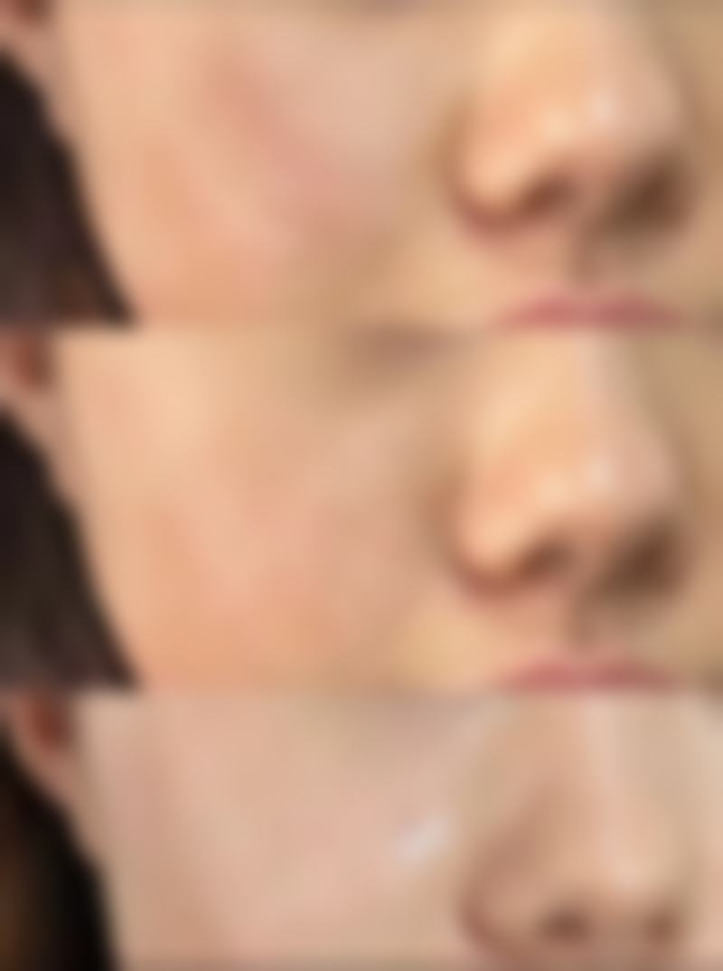 袁兴枝医生看诊优势