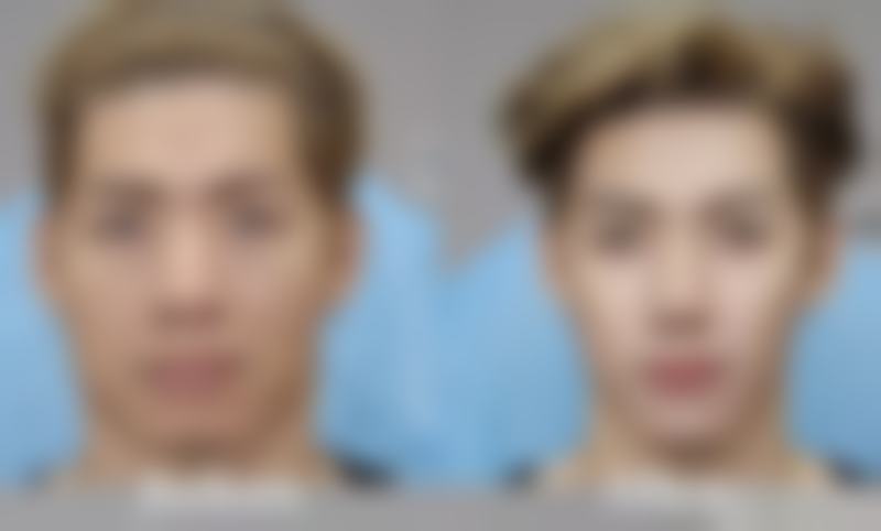 辽宁省人民医院整形外科的眼贴膜能淡化眼袋吗？