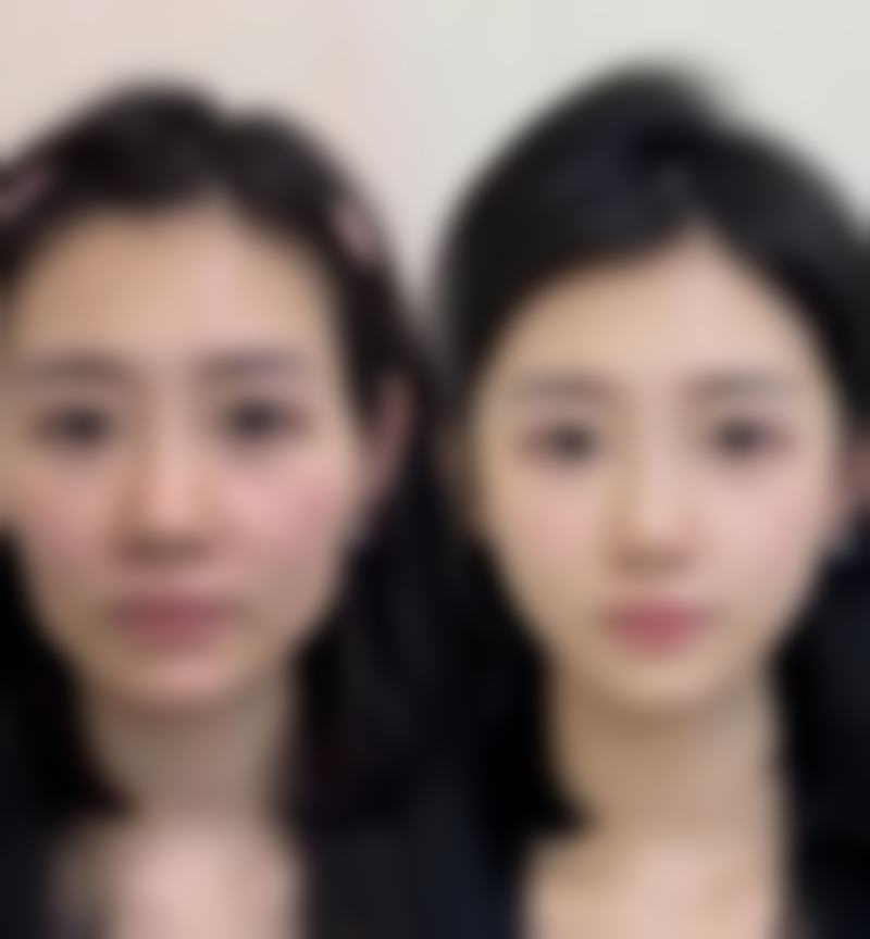 郑可扬医生真实实例：见证美丽奇迹