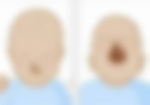 孝感缘临美容整形医院真实实例