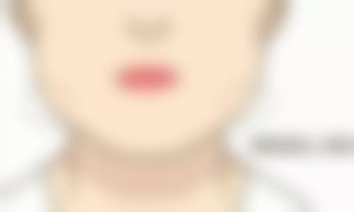 辽宁省人民医院整形外科眼袋切除后遗症多吗