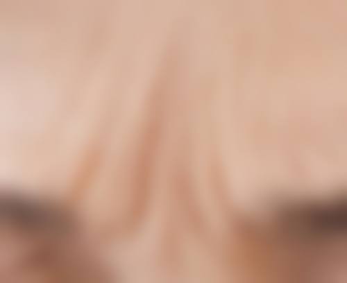 北京嘉禾医疗美容去眼袋适合吗？