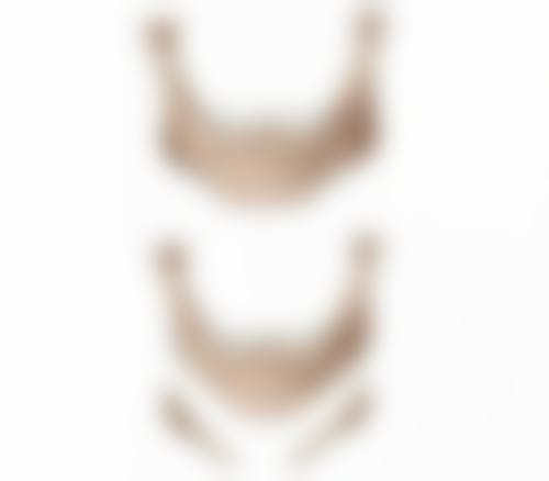 硅胶隆鼻一定会挛缩吗？揭秘3大关键因素助你降低挛缩风险，安心拥有自然美鼻！ 