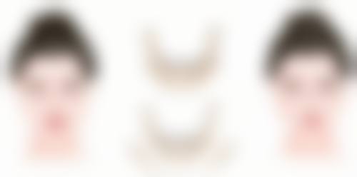 沈阳美莱医疗美容医院的除皱针值不值？