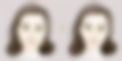 辽宁曙光整形外科医院抽脂后多久见成效靠谱吗？