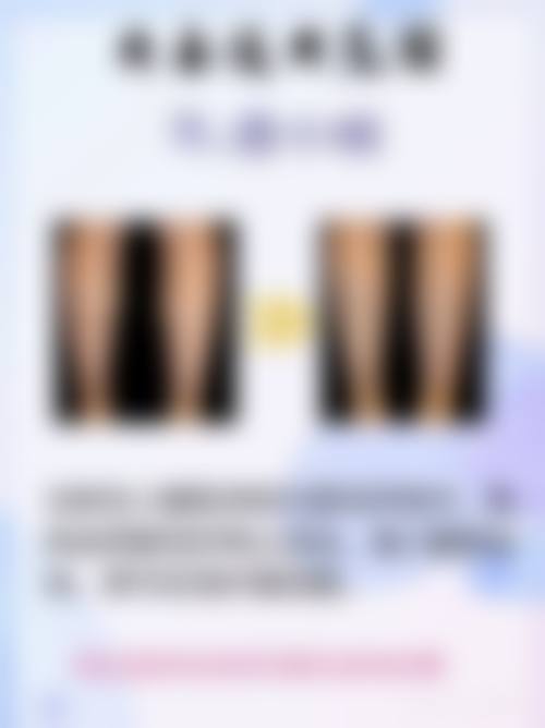 沈阳名流美容医院抽脂后快速见效黄金期有多久？