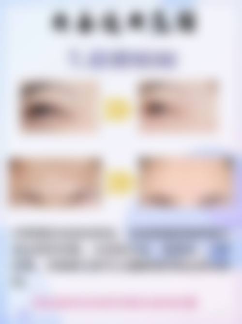 沈阳北方整形医院眼袋切除手术后遗症适合哪些人群