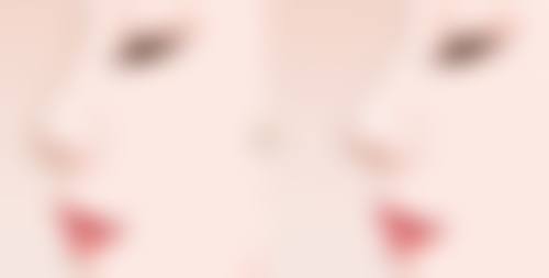 沈阳名流美容医院的除皱针能维持多久？