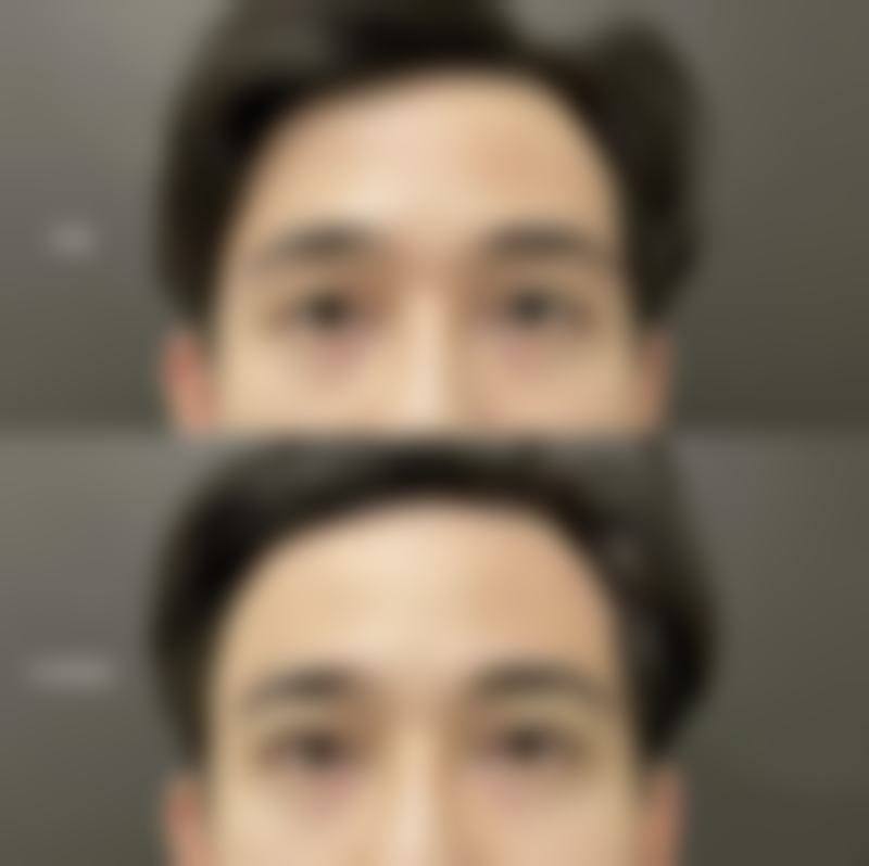 马维骐医生真实实例:看得见的美丽奇迹