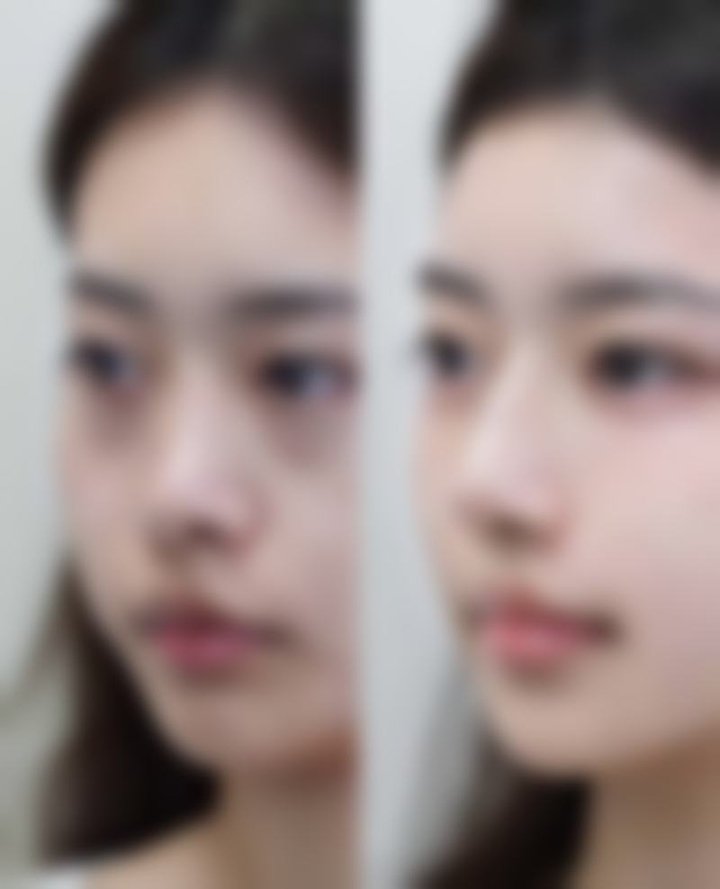 成都温江美都整形口碑怎么样：顾客好评满满