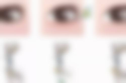 割眼袋要多少天可以运动？术后7天、15天、30天运动注意事项全揭秘，让你科学恢复！ 