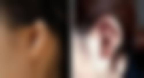 陈瑞阳医生看诊优势：个性化服务暖人心