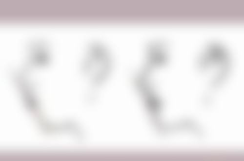 北京嘉禾医疗美容解决埋线双眼皮不双了靠谱吗