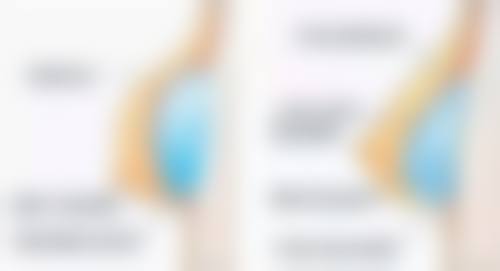 郑可扬医生口碑评价：求美者的一致称赞