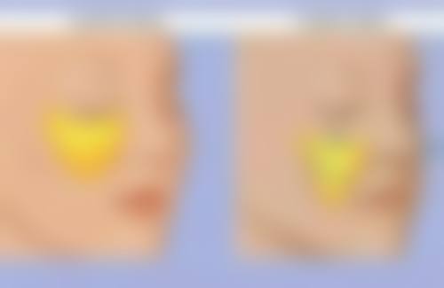 杜锡贤医生真实实例