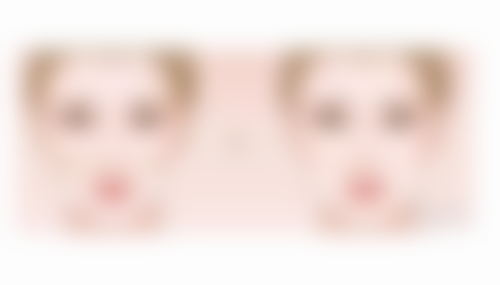 沈阳美莱医疗美容医院修复凹陷疤痕值不值？