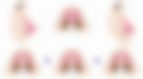 沈阳杏林整形做双眼皮二次手术适合哪些人？