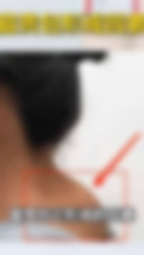 佛山市苏李秀英医院整形美容价格表