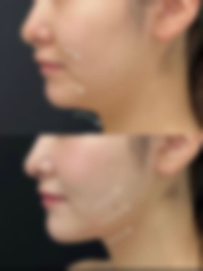 安晶玉医生的技术特点