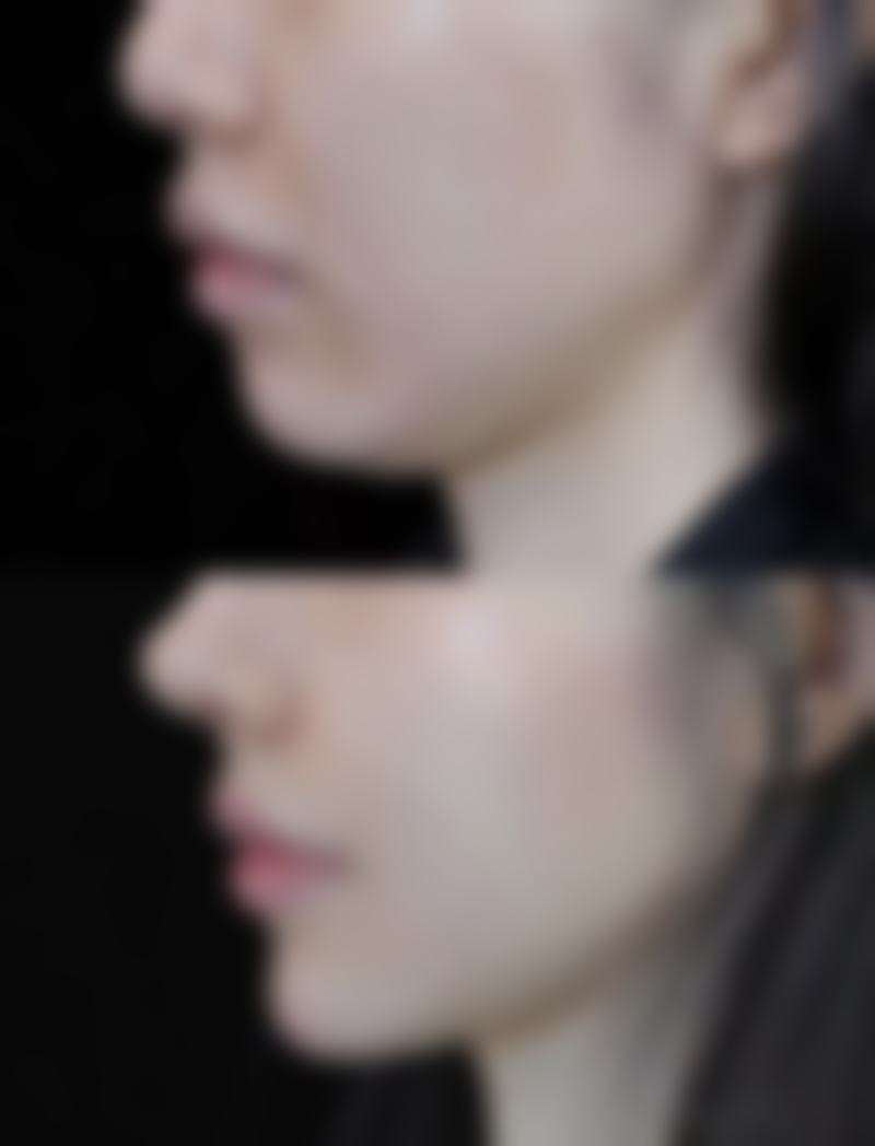 维e乳膏可以去眼袋吗？揭秘3大科学依据，让你告别熊猫眼，重拾紧致双眸不是梦！ 