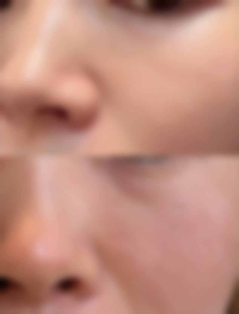 沈阳杏林整形外科医院修复凹陷疤痕靠谱吗？