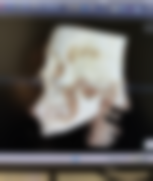 韩国清潭美乐皮肤科用维e乳膏辅助去眼袋适合吗