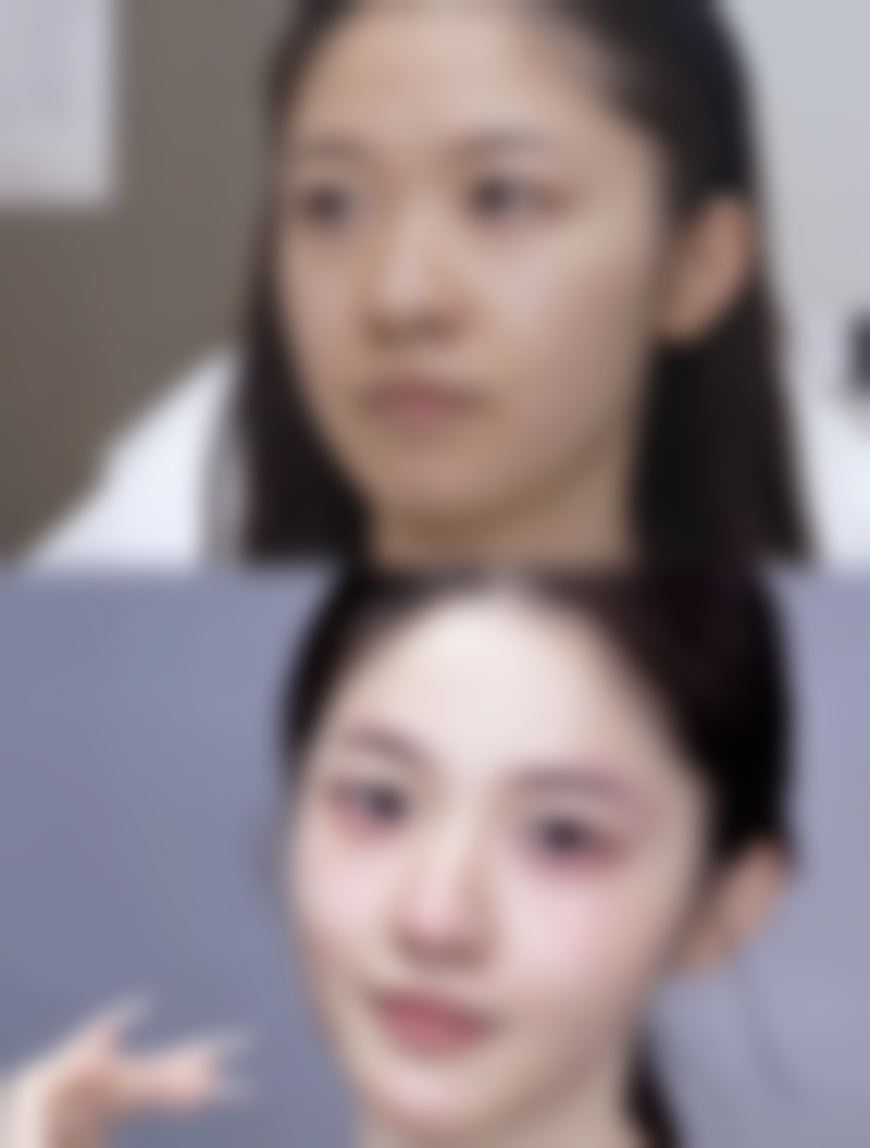 蛋清加蜂蜜去眼袋的科学搭配方法靠谱吗？