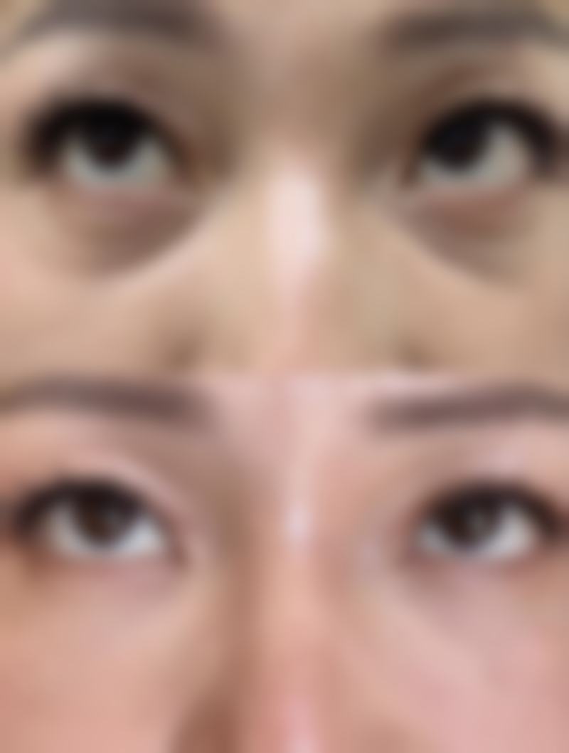 刘永丰医生技术特点:精细与创新并存