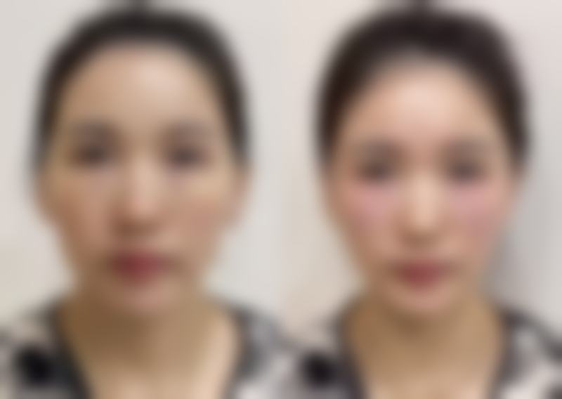 南宁容颜医疗美容诊所擅长项目