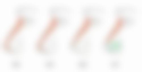 欧阳黎平医生所在机构做全切双眼皮持久度值不值？