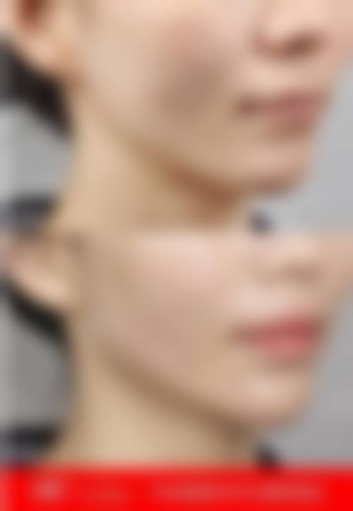 韩国Hansarang女性性整形医院预约挂号方式：便捷效率高，轻松预约