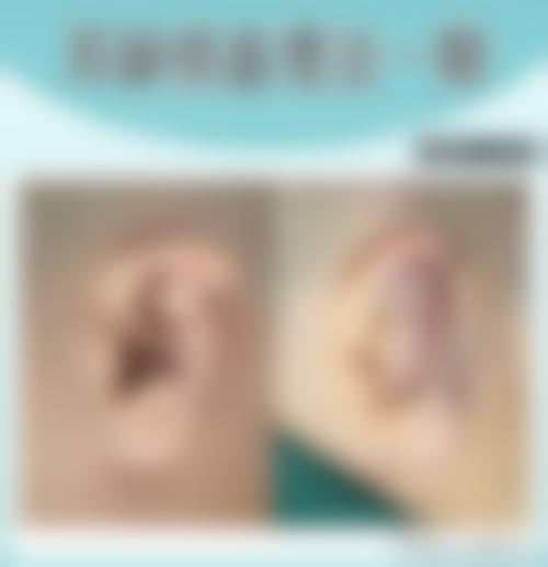 韩国Hansarang女性性整形医院真实实例：美丽蜕变，见证奇迹