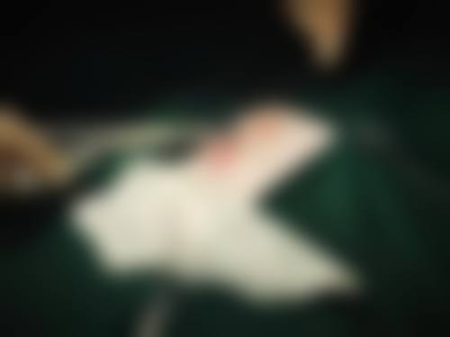 合肥艾蓓缇整形医院仪器设备:精良科技助力美丽升级