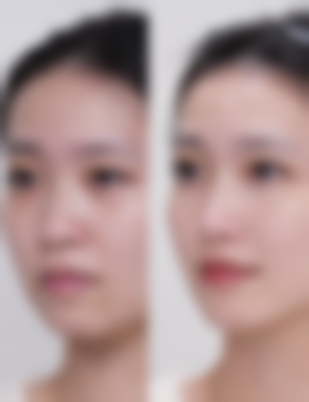 西安好年华医疗美容门诊部口碑怎么样：顾客的好评就是更好的证明