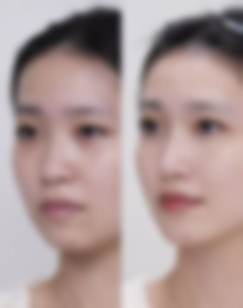 合肥艾蓓缇整形医院地址及乘车路线:轻松找到变得更美之地