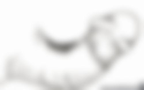 西安莲湖西交疤痕医院治疗疤痕体质增生成效怎么样